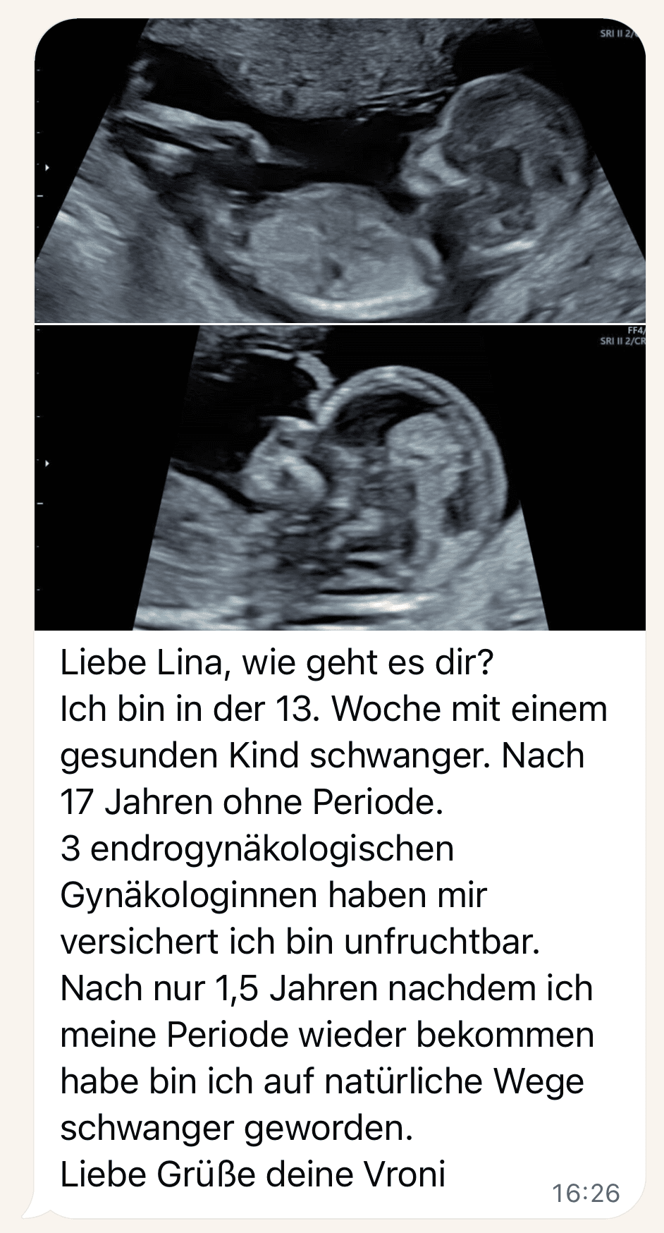 Ultrasound images and Vroni’s message: pregnant naturally, after 17 years without a period